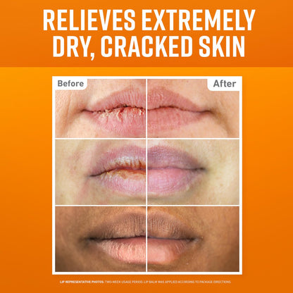 O'Keeffe's Lip Repair Lip Balm Set for Dry, Cracked Lips - Stick (Pack of 3: 1 Cooling + 1 Unscented + 1 SPF) - Moisturizer for Extremely Cracked, Dry Lips