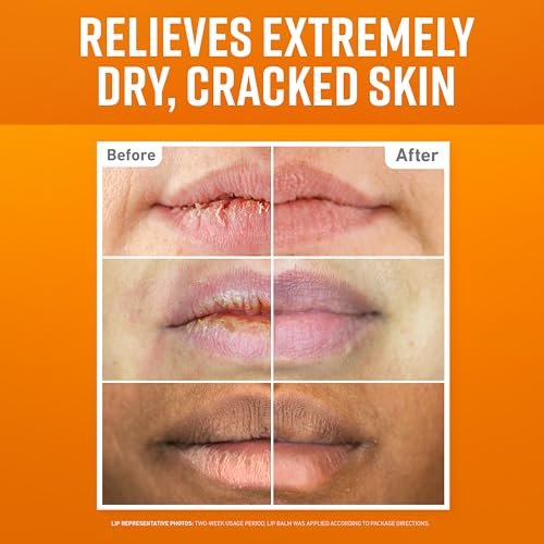O'Keeffe's Lip Repair Lip Balm Set for Dry, Cracked Lips - Stick (Pack of 3: 1 Cooling + 1 Unscented + 1 SPF) - Moisturizer for Extremely Cracked, Dry Lips - görsel 4