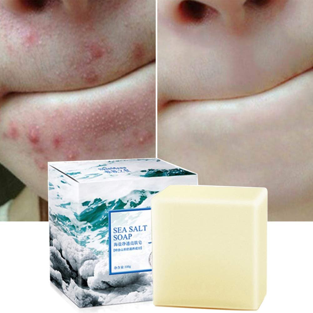 Fabussa Natural Goat's Milk Soap with Sea Salt – for Face, Dry, Oily, Acne-Prone, and Anti-Cellulite (3.52 oz) - görsel 1