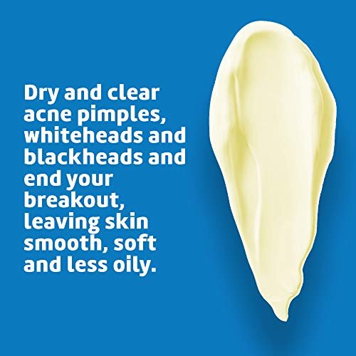 De La Cruz 5% Sulfur Ointment – Cystic Acne Treatment for Face and Body – Daily 10 Minute Spot Treatment Mask – Hormonal Acne Relief, 2.6 oz - görsel 8