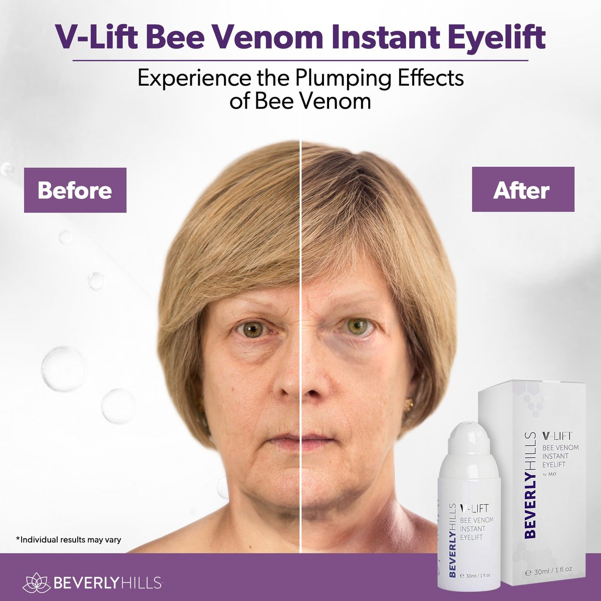Beverly Hills V-Lift Instant Eye Lift & Eye Tuck Bee Venom Serum – 30mL (120-Day Supply) for Puffy Eyes, Dark Circles, Wrinkles & Under Eye Bags Avelisse