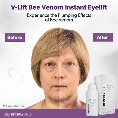 Beverly Hills V-Lift Instant Eye Lift & Eye Tuck Bee Venom Serum – 30mL (120-Day Supply) for Puffy Eyes, Dark Circles, Wrinkles & Under Eye Bags Avelisse