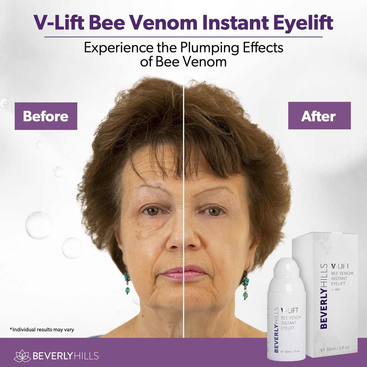 Beverly Hills V-Lift Instant Eye Lift & Eye Tuck Bee Venom Serum – 30mL (120-Day Supply) for Puffy Eyes, Dark Circles, Wrinkles & Under Eye Bags Avelisse