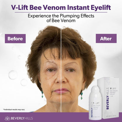 Beverly Hills V-Lift Instant Eye Lift & Eye Tuck Bee Venom Serum – 30mL (120-Day Supply) for Puffy Eyes, Dark Circles, Wrinkles & Under Eye Bags Avelisse