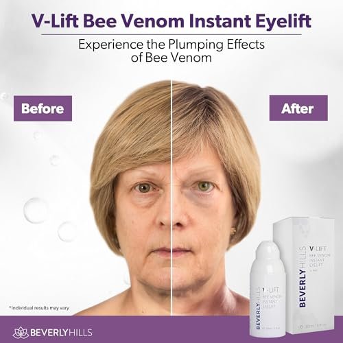 Beverly Hills V-Lift Instant Eye Lift & Eye Tuck Bee Venom Serum – 30mL (120-Day Supply) for Puffy Eyes, Dark Circles, Wrinkles & Under Eye Bags Avelisse
