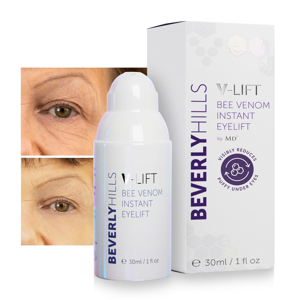 Beverly Hills V-Lift Instant Eye Lift & Eye Tuck Bee Venom Serum – 30mL (120-Day Supply) for Puffy Eyes, Dark Circles, Wrinkles & Under Eye Bags Avelisse