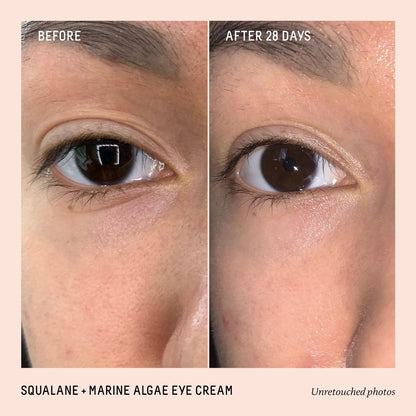 BIOSSANCE Squalane and Marine Algae Eye Cream - Anti-Aging Eye Cream for Fine Lines, Wrinkles, and Puffiness - Hydrating & Lifting Formula with Hyaluronic Acid and Paracress Extract - 0.5 oz Avelisse