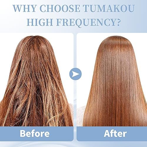 TUMAKOU High Frequency Facial Machine - Portable Handheld Skin Wand with 4 Tubes for Acne, Wrinkle & Skin Rejuvenation Avelisse