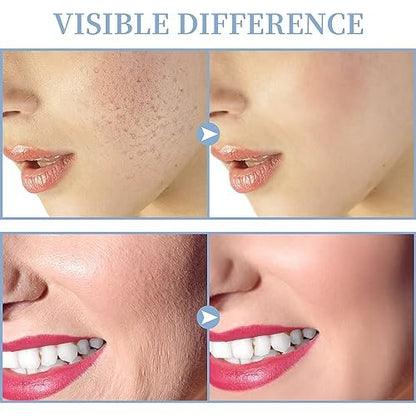 TUMAKOU High Frequency Facial Machine - Portable Handheld Skin Wand with 4 Tubes for Acne, Wrinkle & Skin Rejuvenation Avelisse
