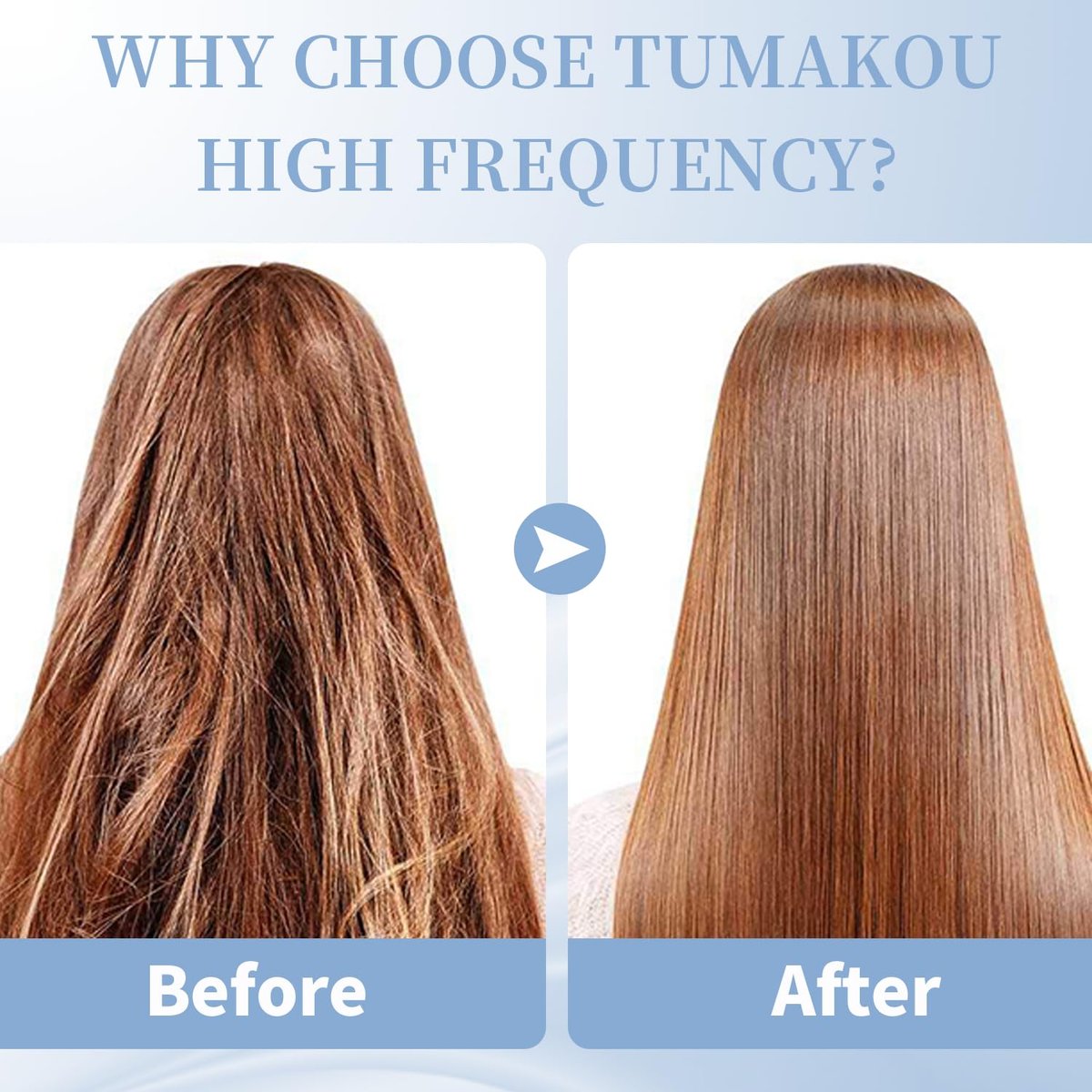 TUMAKOU High Frequency Facial Machine - Portable Handheld Skin Wand with 4 Tubes for Acne, Wrinkle & Skin Rejuvenation Avelisse