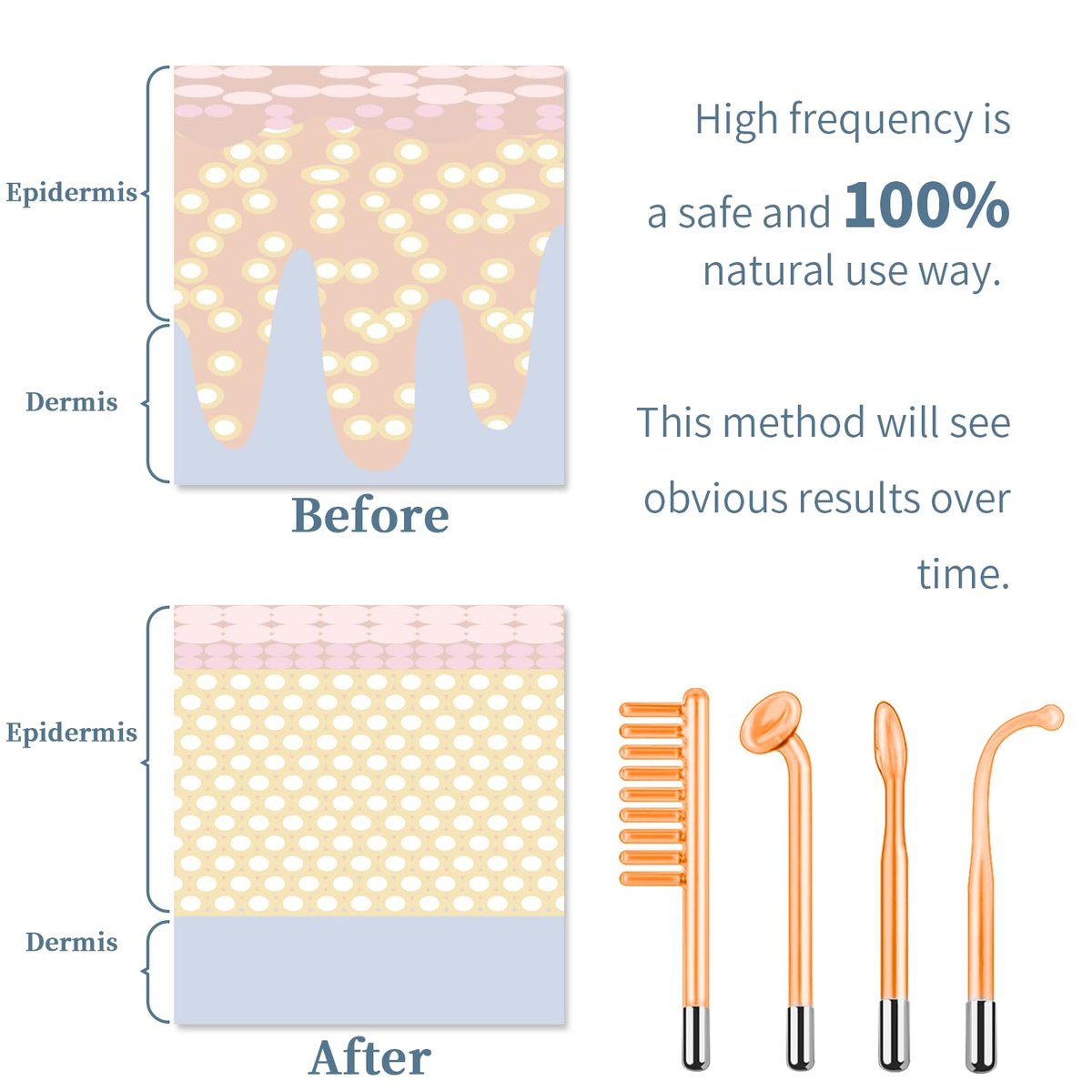 TUMAKOU High Frequency Facial Machine - Portable Handheld Skin Wand with 4 Tubes for Acne, Wrinkle & Skin Rejuvenation Avelisse