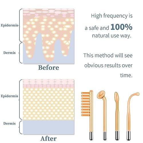 TUMAKOU High Frequency Facial Machine - Portable Handheld Skin Wand with 4 Tubes for Acne, Wrinkle & Skin Rejuvenation Avelisse