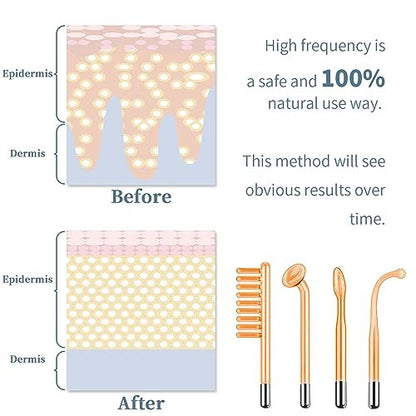 TUMAKOU High Frequency Facial Machine - Portable Handheld Skin Wand with 4 Tubes for Acne, Wrinkle & Skin Rejuvenation Avelisse