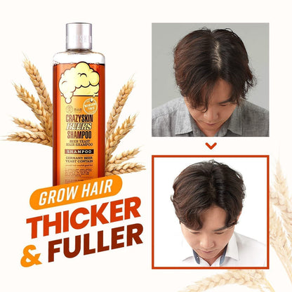 CRAZY SKIN German Beers Yeast Biotin Shampoo - Anti-Hair Loss & Thickening, Gentle Exfoliating Scalp Treatment with Panthenol, Collagen, Sulfate-Free, 300ml