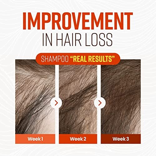 CRAZY SKIN German Beers Yeast Biotin Shampoo - Anti-Hair Loss & Thickening, Gentle Exfoliating Scalp Treatment with Panthenol, Collagen, Sulfate-Free, 300ml - görsel 6