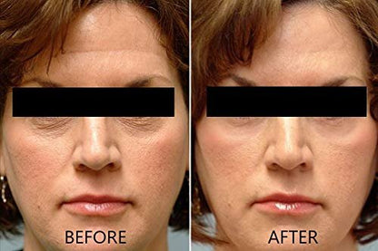 Vitamin C Serum 20% Pure L-Ascorbic Acid with Ferulic Acid, Vitamin E, HA, and Vitamin B5 for Face and Eyes - Natural Anti Aging Anti Wrinkle Serum Set of 2 by Dr. Brenner Avelisse