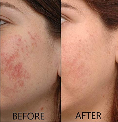 Vitamin C Serum 20% Pure L-Ascorbic Acid with Ferulic Acid, Vitamin E, HA, and Vitamin B5 for Face and Eyes - Natural Anti Aging Anti Wrinkle Serum Set of 2 by Dr. Brenner Avelisse