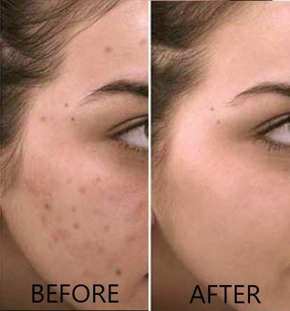 Vitamin C Serum 20% Pure L-Ascorbic Acid with Ferulic Acid, Vitamin E, HA, and Vitamin B5 for Face and Eyes - Natural Anti Aging Anti Wrinkle Serum Set of 2 by Dr. Brenner Avelisse