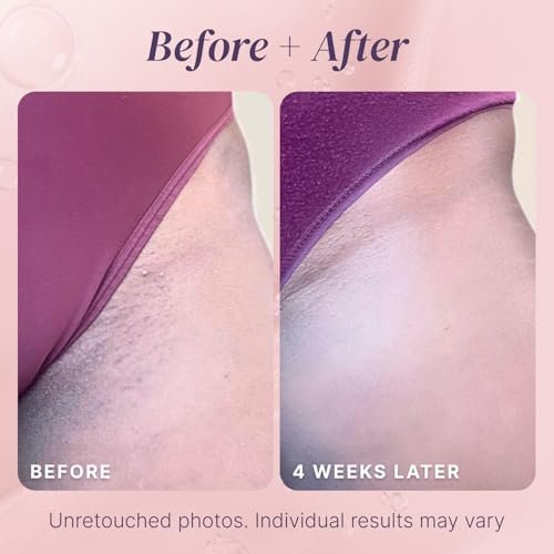Razor Bump Stopper with Dark Spot Remover - Salicylic Acid After Shave Solution for Ingrown Hairs & Razor Burns, 3 Fl Oz - görsel 15