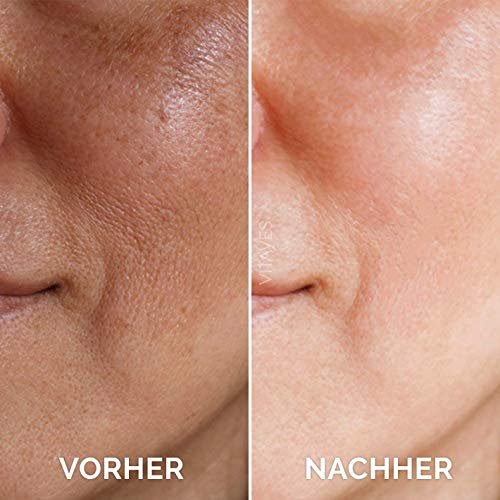 VITAYES Vitamin C Face Serum with Hyaluronic Acid – Anti-Aging, Brightening & Hydrating Serum for Dark Spots, Fine Lines & Wrinkles – 1 Oz - görsel 8