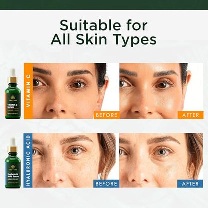 Tree of Life Beauty Facial Skin Care Set - Vitamin C & Hyaluronic Acid Serums for Brightening, Firming & Hydrating | 2-Pack, 1 Fl Oz Each Avelisse