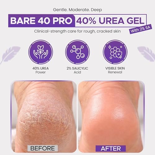 BARE 40 PRO 40% Urea Gel with 2% Salicylic Acid, Hyaluronic Acid, Tea Tree Oil & Aloe Vera – Exfoliating & Hydrating Foot and Body Gel for Dry, Rough Skin, 4oz Jar, Made in USA Avelisse