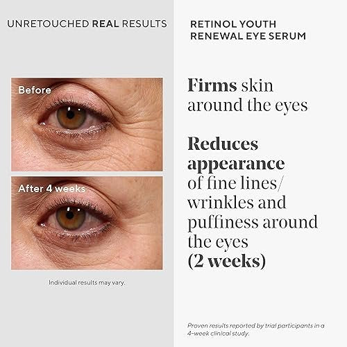 Murad Retinol Youth Renewal Eye Serum - Visibly Improves Undereye Puffiness, Dark Circles & Fine Lines - Gentle Nightly Retinol Eye Serum - 0.5 oz Avelisse