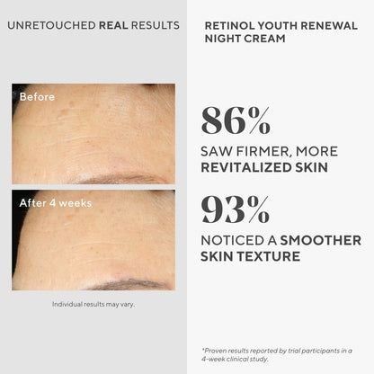 Murad Retinol Youth Renewal Night Cream - Anti-Aging Moisturizer with Retinol Tri-Active Technology and Niacinamide, Fights Wrinkles and Fine Lines, Boosts Radiance and Firms Skin - 1.7 Fl Oz Avelisse