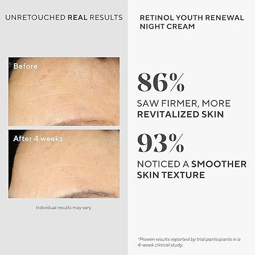 Murad Retinol Youth Renewal Night Cream - Anti-Aging Moisturizer with Retinol Tri-Active Technology and Niacinamide, Fights Wrinkles and Fine Lines, Boosts Radiance and Firms Skin - 1.7 Fl Oz Avelisse
