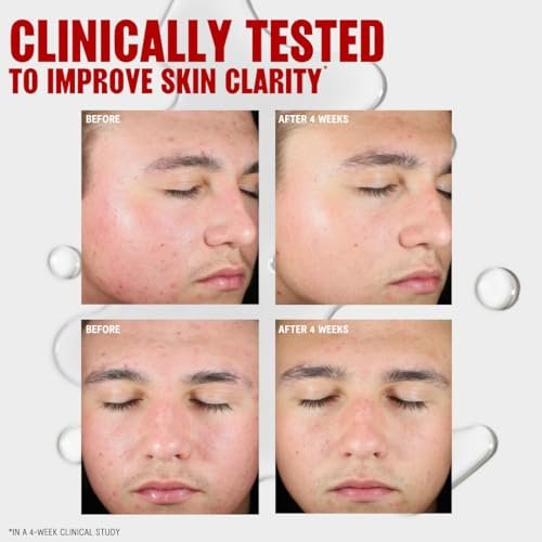 Thayers Blemish Clearing Salicylic Acid Toner - Acne Treatment Face Toner with 2% Salicylic Acid, Soothing & Non-Stripping, 12 Fl Oz - görsel 9