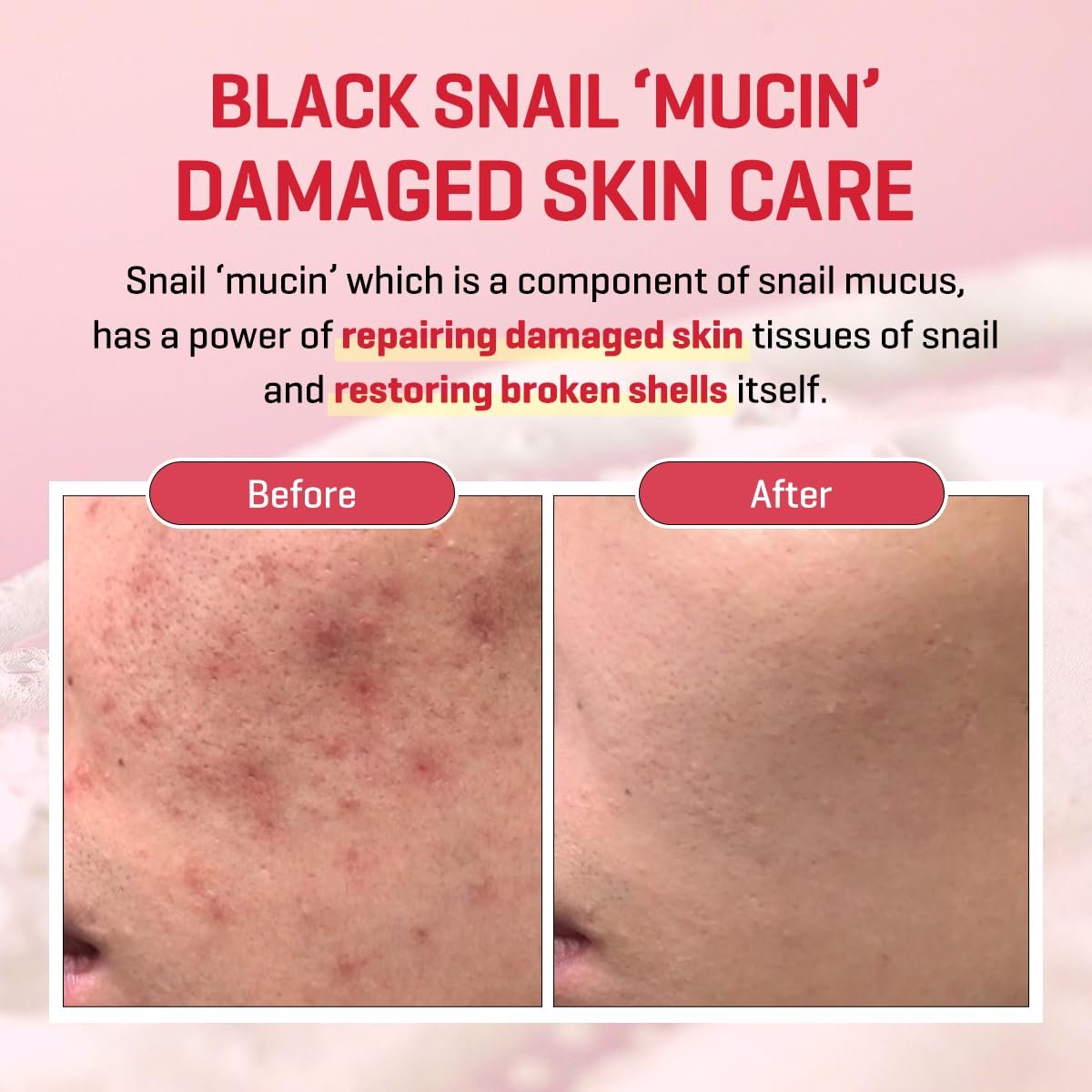 SOME BY MI Snail Truecica Miracle Repair Cream - 2.02 Oz (60ml) - Snail Mucin Face Moisturizer for Sensitive Skin, Acne Marks, and Skin Barrier Strengthening - Korean Skincare - görsel 7