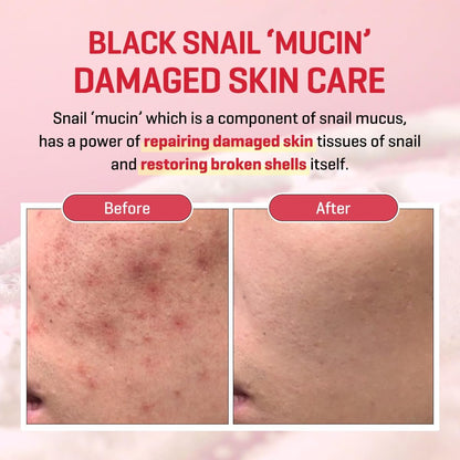SOME BY MI Snail Truecica Miracle Repair Cream - 2.02 Oz (60ml) - Snail Mucin Face Moisturizer for Sensitive Skin, Acne Marks, and Skin Barrier Strengthening - Korean Skincare