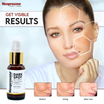 Neoprosone Dark Spot Remover for Face & Body - Brightening Cream for Blemishes, Sun Spots, Brown Spots - 1 Fl Oz Avelisse