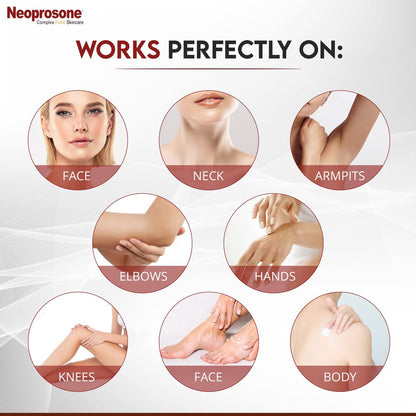 Neoprosone Dark Spot Remover for Face & Body - Brightening Cream for Blemishes, Sun Spots, Brown Spots - 1 Fl Oz Avelisse