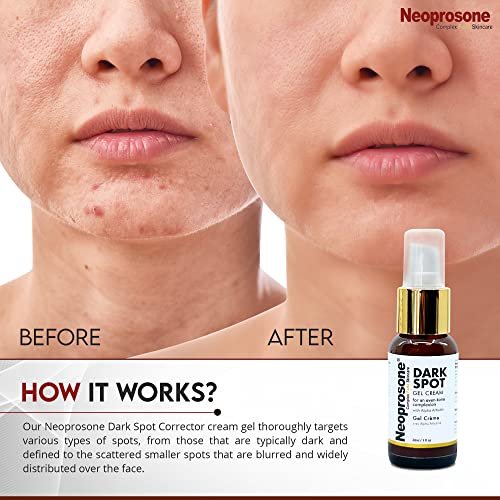 Neoprosone Dark Spot Remover for Face & Body - Brightening Cream for Blemishes, Sun Spots, Brown Spots - 1 Fl Oz Avelisse