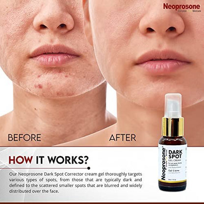 Neoprosone Dark Spot Remover for Face & Body - Brightening Cream for Blemishes, Sun Spots, Brown Spots - 1 Fl Oz Avelisse