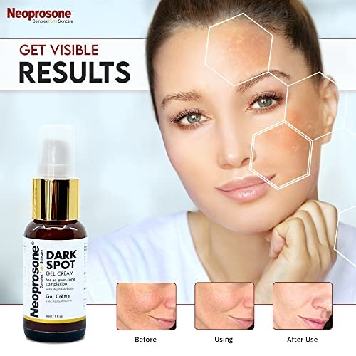 Neoprosone Dark Spot Remover for Face & Body - Brightening Cream for Blemishes, Sun Spots, Brown Spots - 1 Fl Oz Avelisse