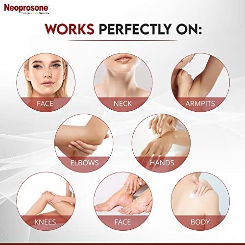 Neoprosone Dark Spot Remover for Face & Body - Brightening Cream for Blemishes, Sun Spots, Brown Spots - 1 Fl Oz Avelisse