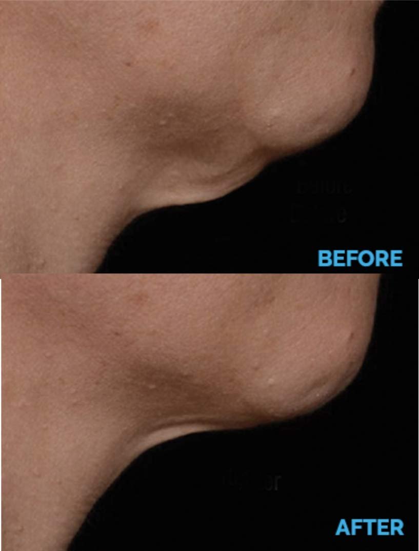 AminoGenesis N.E.C.K Control - Neck Lifting, Firming and Retracting Cream - görsel 10