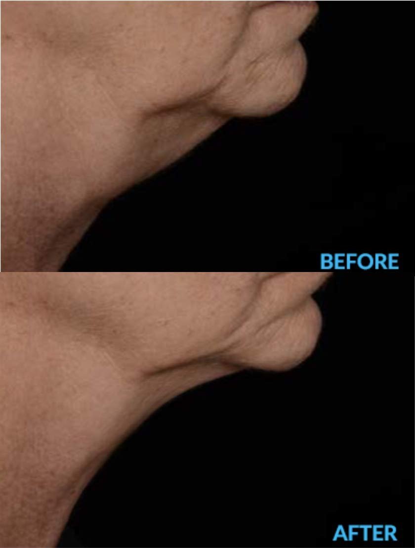 AminoGenesis N.E.C.K Control - Neck Lifting, Firming and Retracting Cream - görsel 7
