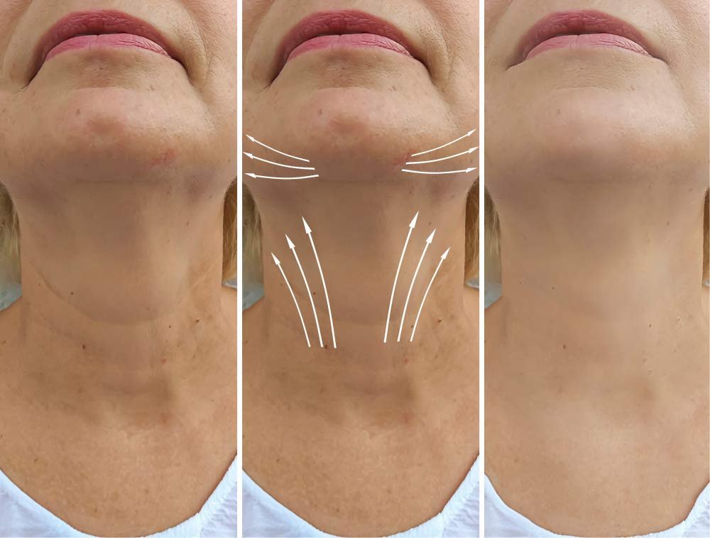 AminoGenesis N.E.C.K Control - Neck Lifting, Firming and Retracting Cream - görsel 3