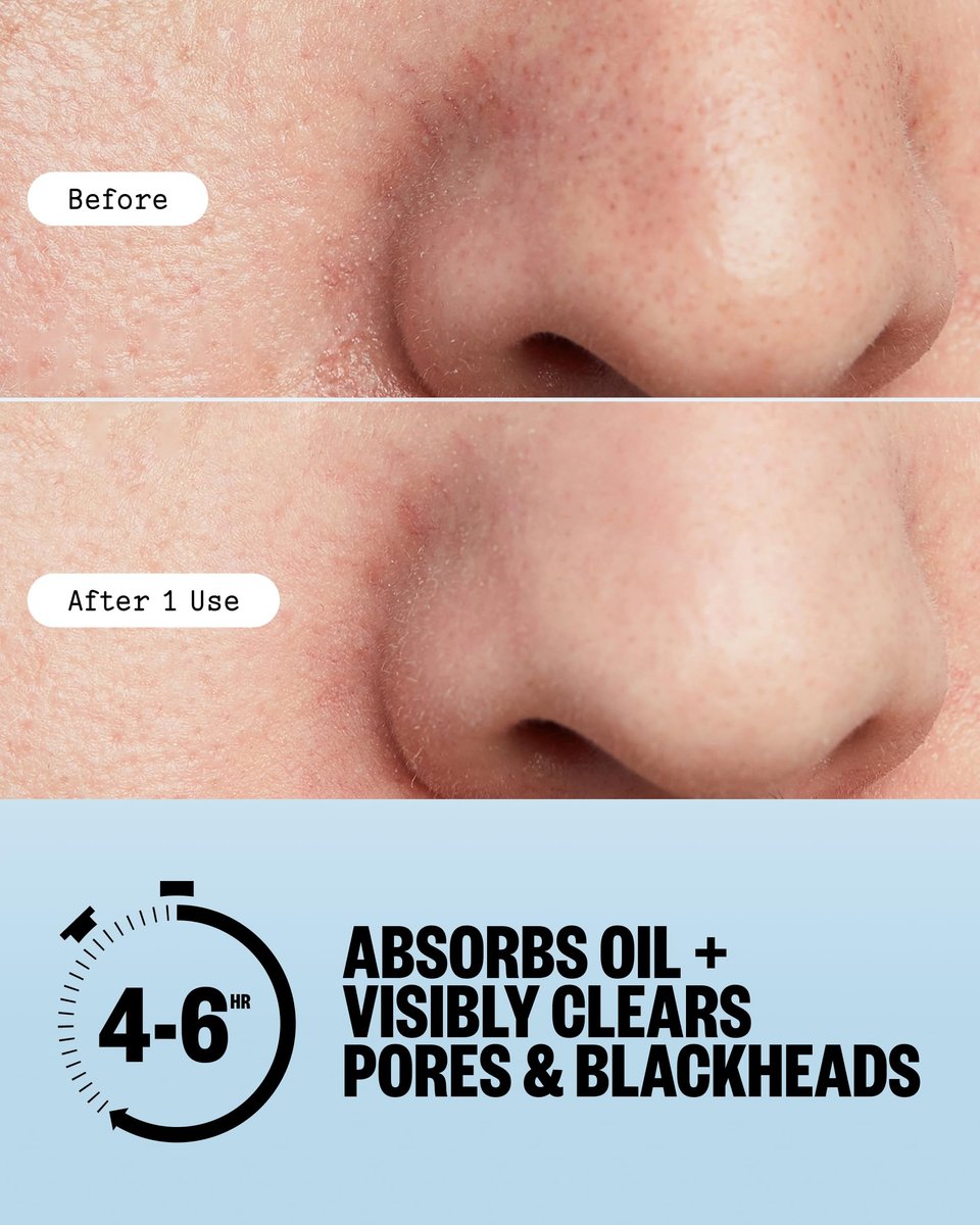 PEACE OUT Pore Strips for Nose and Face – Oil Absorbing Hydrocolloid Blackhead Remover, Pore Minimizing Strips with Retinol, Multi-Use Face Strips for Clogged Pores (8 Count) Avelisse