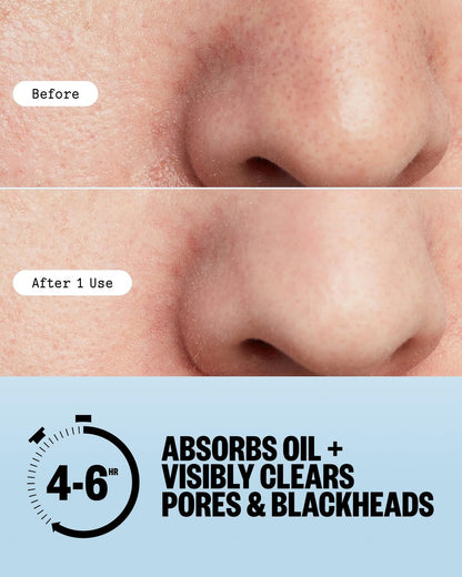 PEACE OUT Pore Strips for Nose and Face – Oil Absorbing Hydrocolloid Blackhead Remover, Pore Minimizing Strips with Retinol, Multi-Use Face Strips for Clogged Pores (8 Count) Avelisse