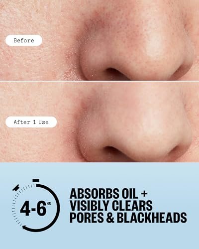 PEACE OUT Pore Strips for Nose and Face – Oil Absorbing Hydrocolloid Blackhead Remover, Pore Minimizing Strips with Retinol, Multi-Use Face Strips for Clogged Pores (8 Count) Avelisse