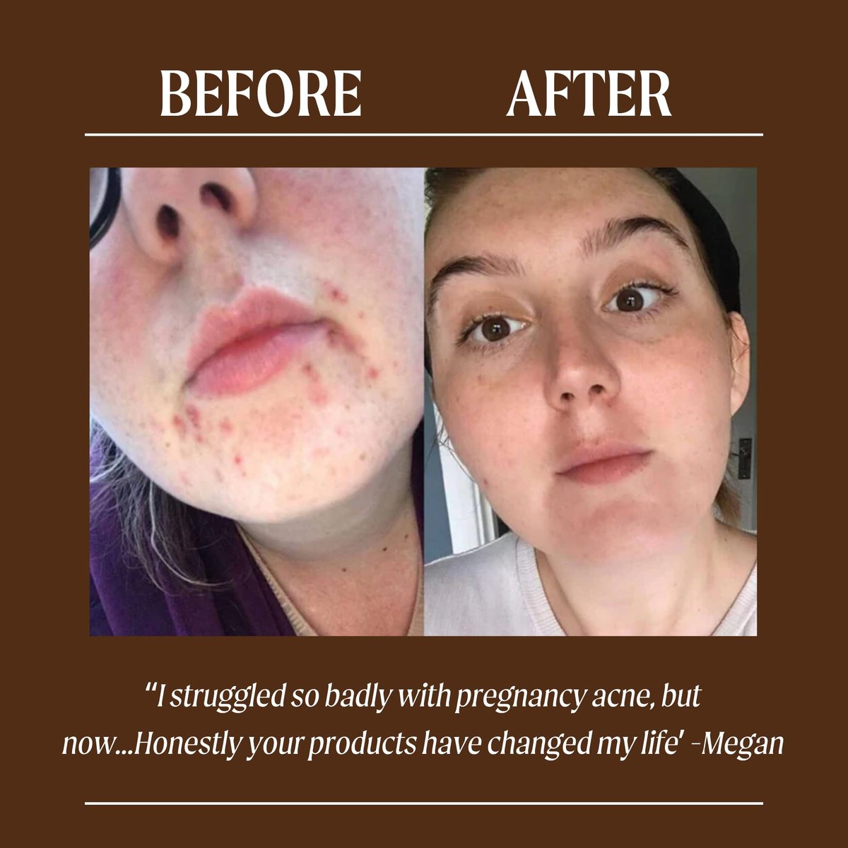 UPCIRCLE Face Moisturiser with Argan Powder - Nourishing Day Cream, Vitamin E, Aloe Vera, Glycerin, Shea & Coconut Butter - Natural Vegan Cruelty-Free 1.7oz Avelisse
