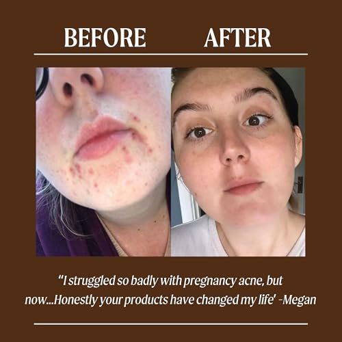 UPCIRCLE Face Moisturiser with Argan Powder - Nourishing Day Cream, Vitamin E, Aloe Vera, Glycerin, Shea & Coconut Butter - Natural Vegan Cruelty-Free 1.7oz Avelisse