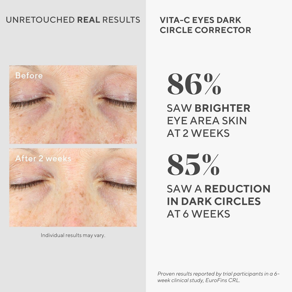Murad Vita-C Eyes Dark Circle Corrector – Gold-Stabilized Vitamin C, Algae, and Cucumber Eye Serum for Brightening, Reducing Puffiness, and Smoothing Fine Lines – 0.5 Fl Oz Avelisse