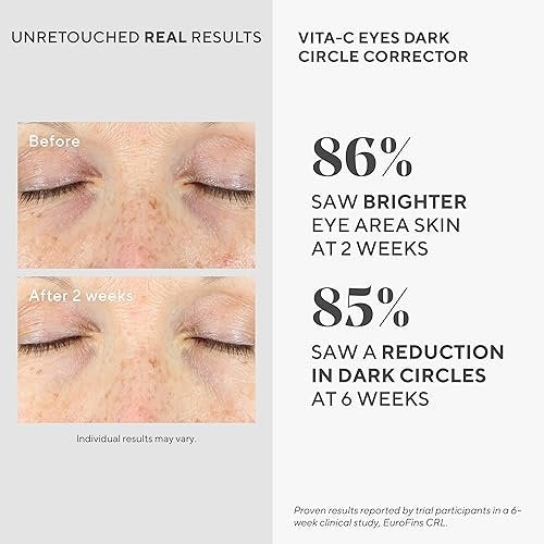 Murad Vita-C Eyes Dark Circle Corrector – Gold-Stabilized Vitamin C, Algae, and Cucumber Eye Serum for Brightening, Reducing Puffiness, and Smoothing Fine Lines – 0.5 Fl Oz Avelisse