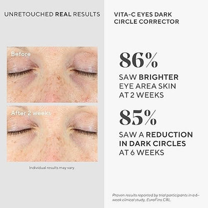 Murad Vita-C Eyes Dark Circle Corrector – Gold-Stabilized Vitamin C, Algae, and Cucumber Eye Serum for Brightening, Reducing Puffiness, and Smoothing Fine Lines – 0.5 Fl Oz Avelisse