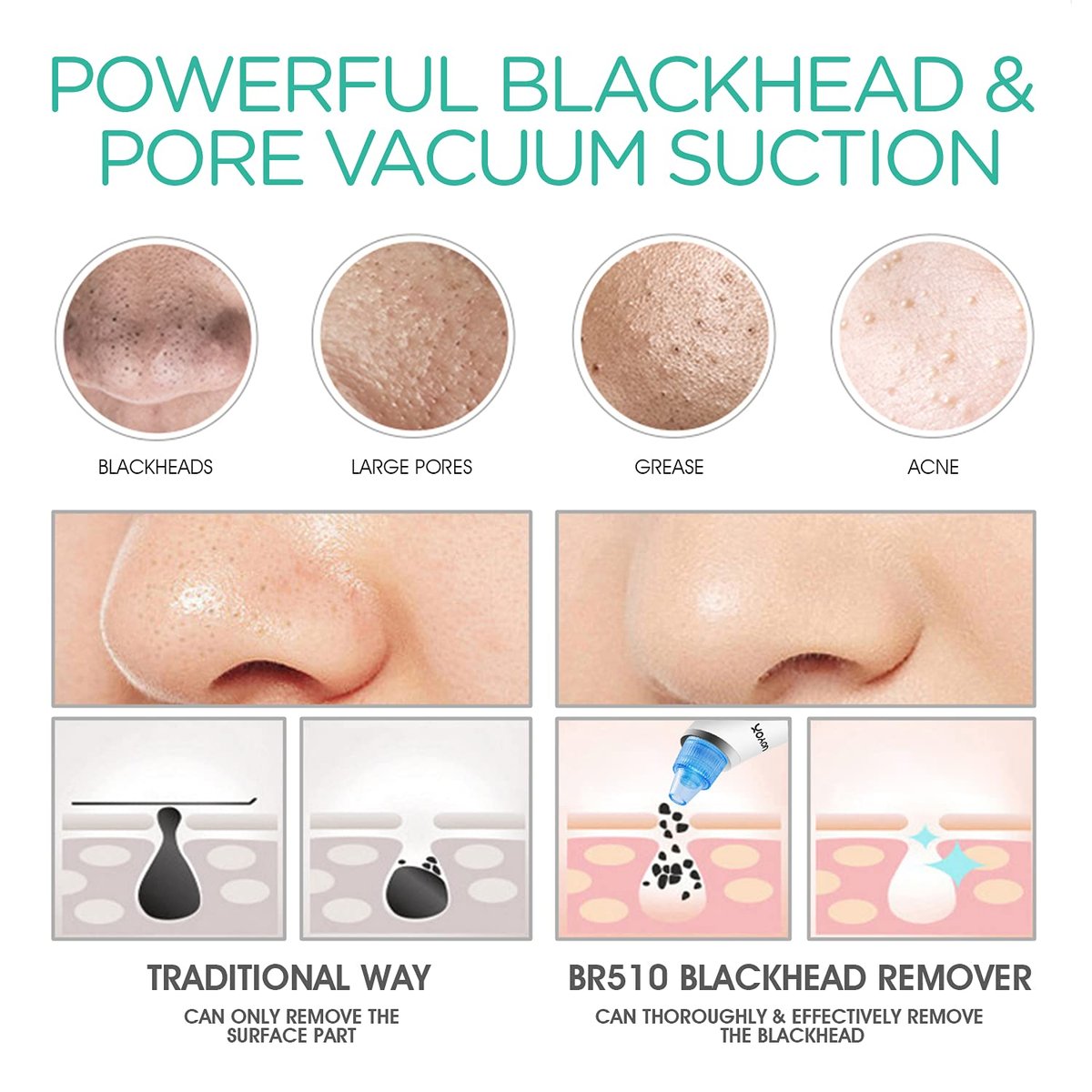 VOYOR Blackhead Remover Pore Vacuum - Black Head Remover for Face with LCD Screen, 5 Suction Levels and 6 Replaceable Heads, USB Rechargeable Face Vacuum Pore Cleaner for Women and Men (BR510) - görsel 5